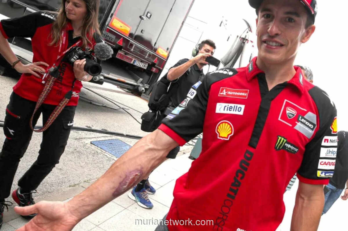 Bekas Luka Cedera Kecelakaan Austin Masih Nyata, Marc Marquez Nekat Balapan di MotoGP Spanyol