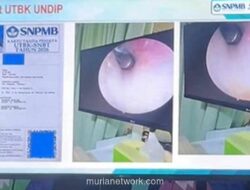 Peserta UTBK SNBT Ketahuan Sembunyikan Alat Bantu di Telinga, Berakhir di Klinik THT
