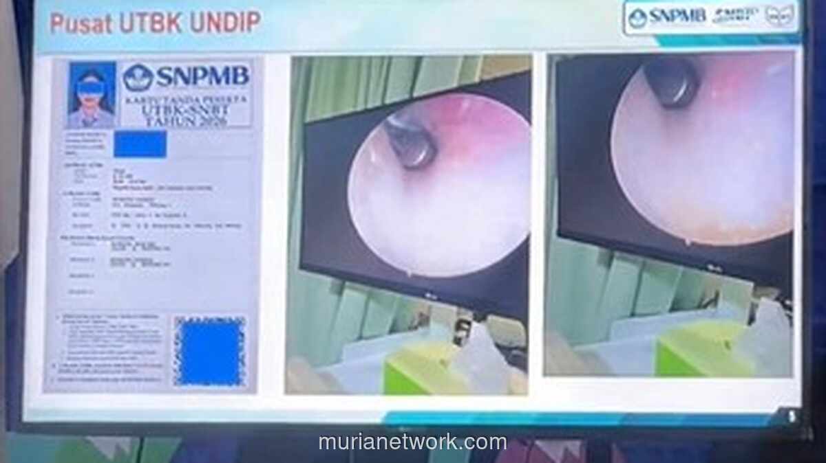Peserta UTBK SNBT Ketahuan Sembunyikan Alat Bantu di Telinga, Berakhir di Klinik THT