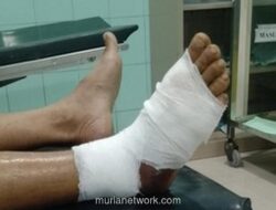 Pria Brebes Alami Komplikasi Usai Digigit Ular Berbisa, BPJS Nonaktif Hambat Penanganan