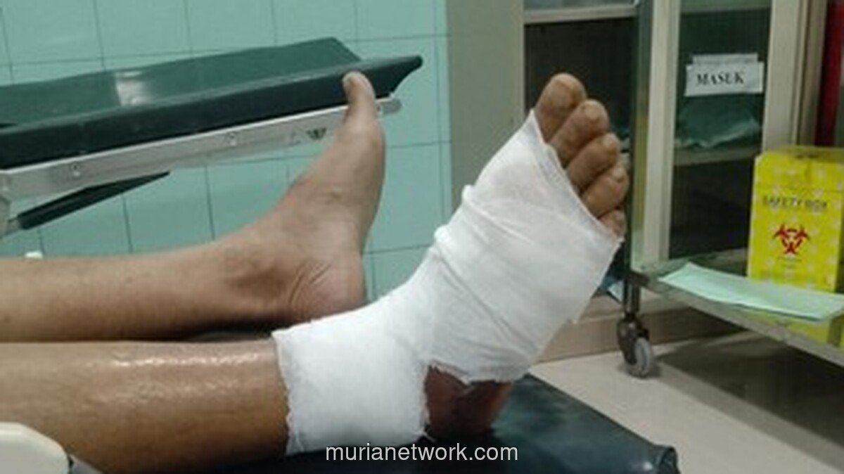 Pria Brebes Alami Komplikasi Usai Digigit Ular Berbisa, BPJS Nonaktif Hambat Penanganan