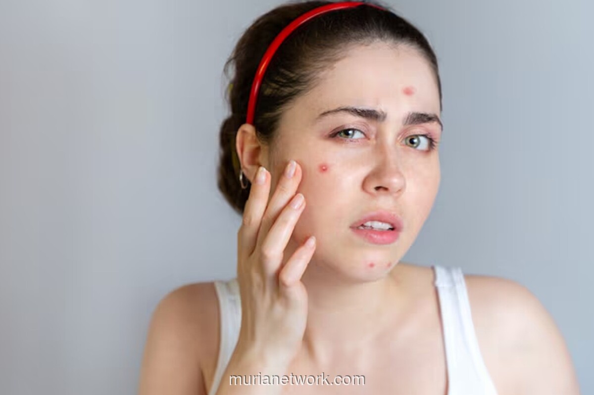Dokter Kulit Ungkap Langkah Awal Atasi Iritasi Akibat Skincare Ilegal