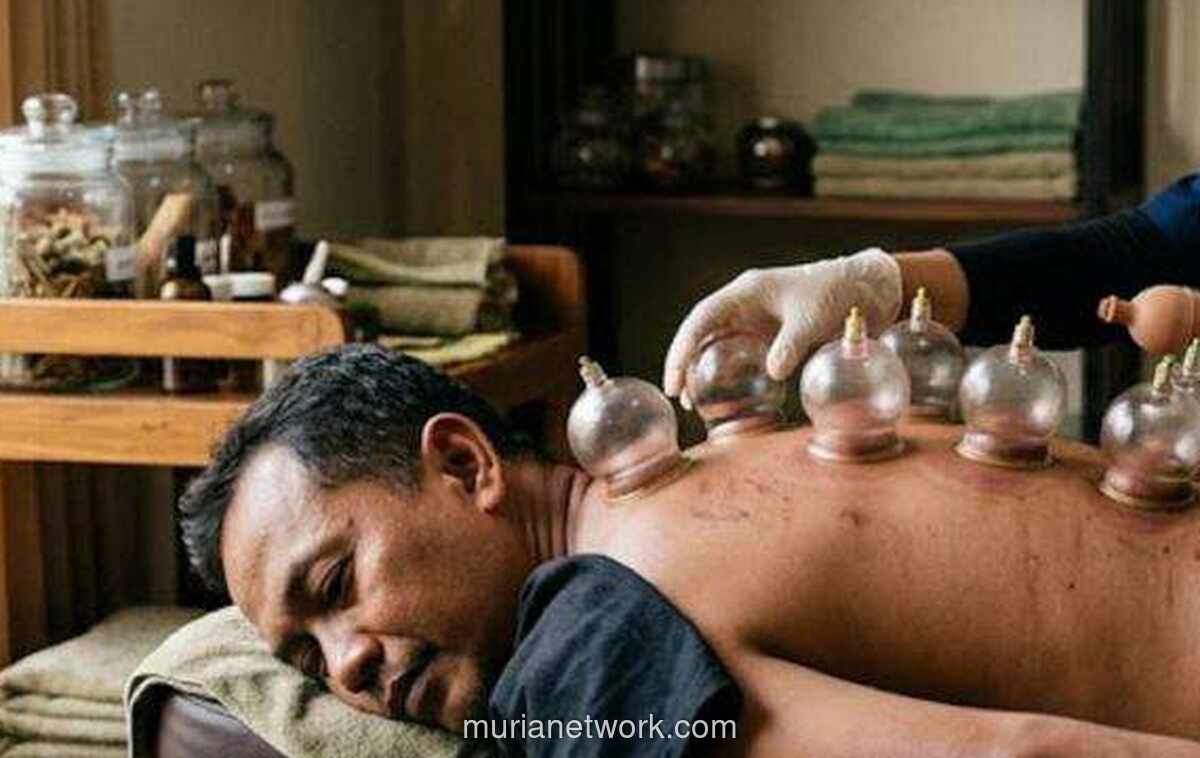 Bekam Bermanfaat untuk Nyeri Punggung dan Leher, Dokter Ingatkan Hanya sebagai Terapi Tambahan
