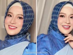 Okie Agustina Jalani Operasi Plastik di Korea Selatan untuk Perbaiki Kantung Mata