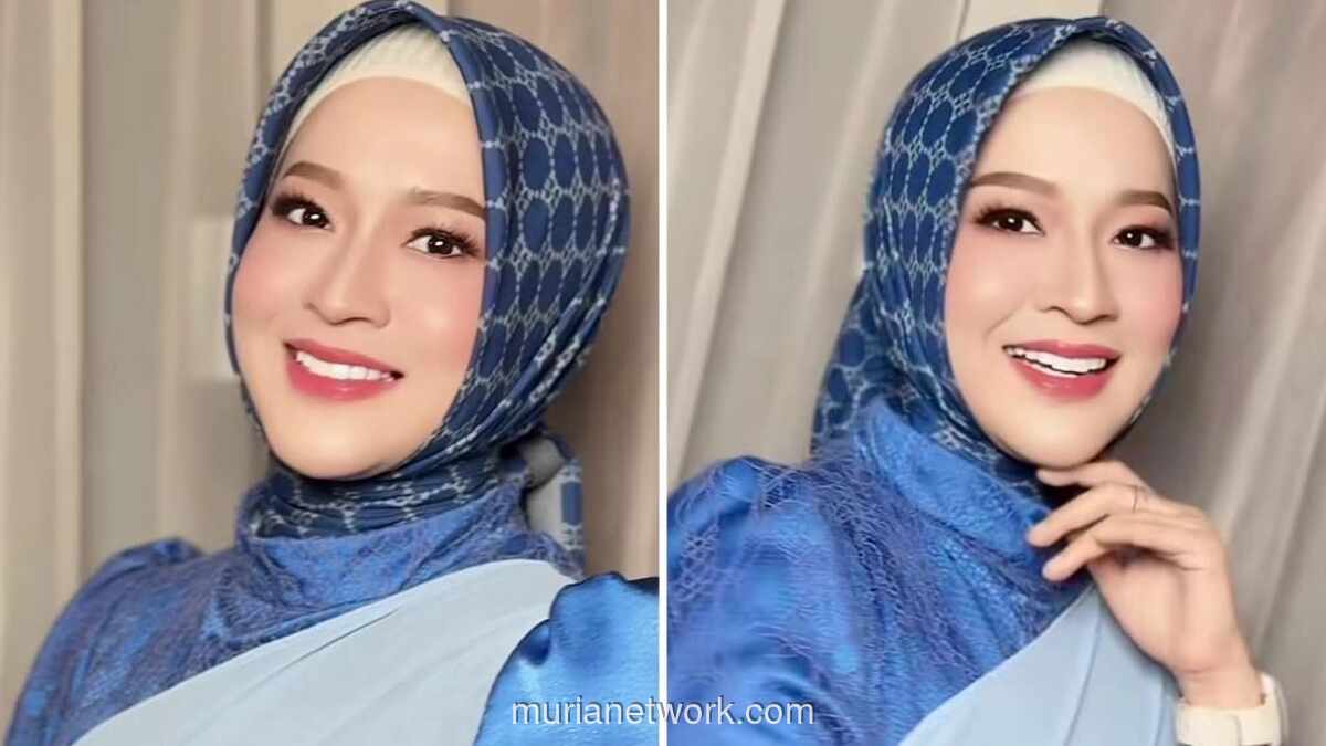Okie Agustina Jalani Operasi Plastik di Korea Selatan untuk Perbaiki Kantung Mata