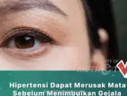 Hipertensi Bisa Sebabkan Kebutaan, Teknologi Laser Diklaim Bantu Atasi Penggumpalan Darah
