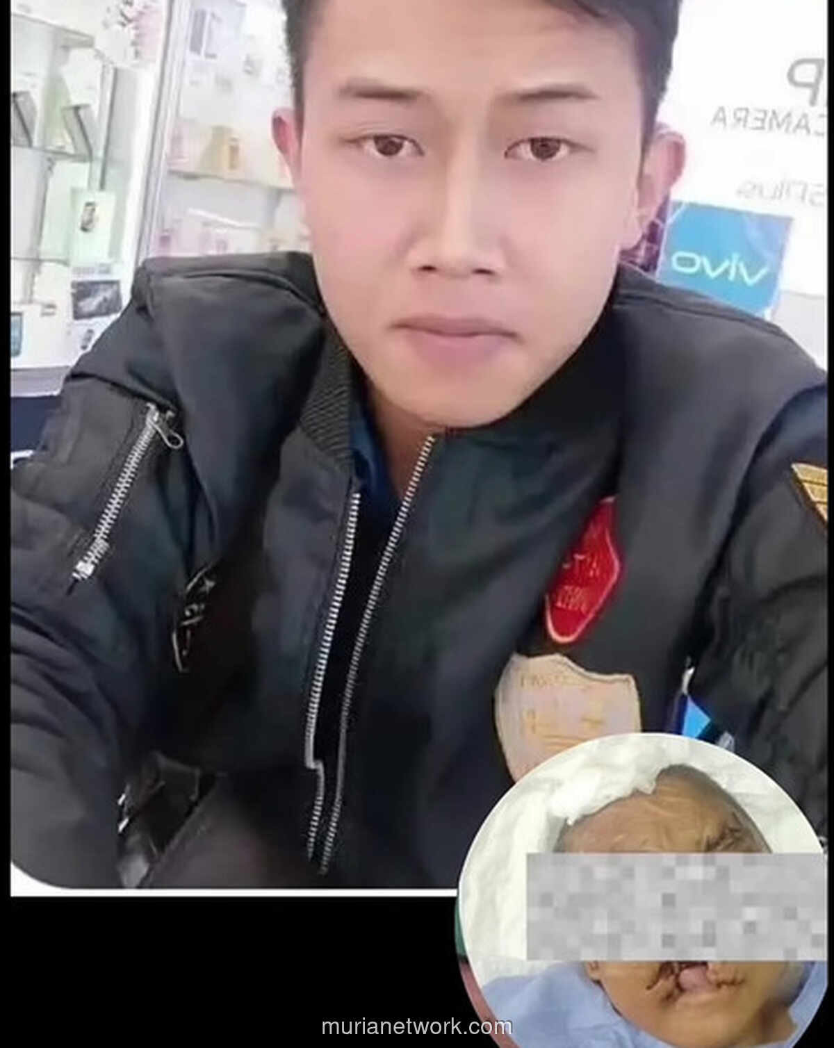 Luka Kepala Korban Penyekapan di Bandung Terinfeksi Parah hingga Muncul Belatung, Pelaku Cemburu Jadi Motif