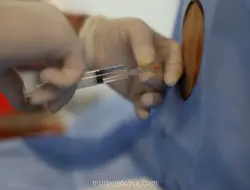 Benarkah Bius Spinal saat Caesar Bikin Badan Lemah? Ini Kata Dokter