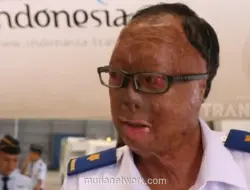 Kapten Sigit Hani Hadiyanto, Pilot yang Selamat dari Kecelakaan Pesawat dan Bangkit dengan 21 Operasi